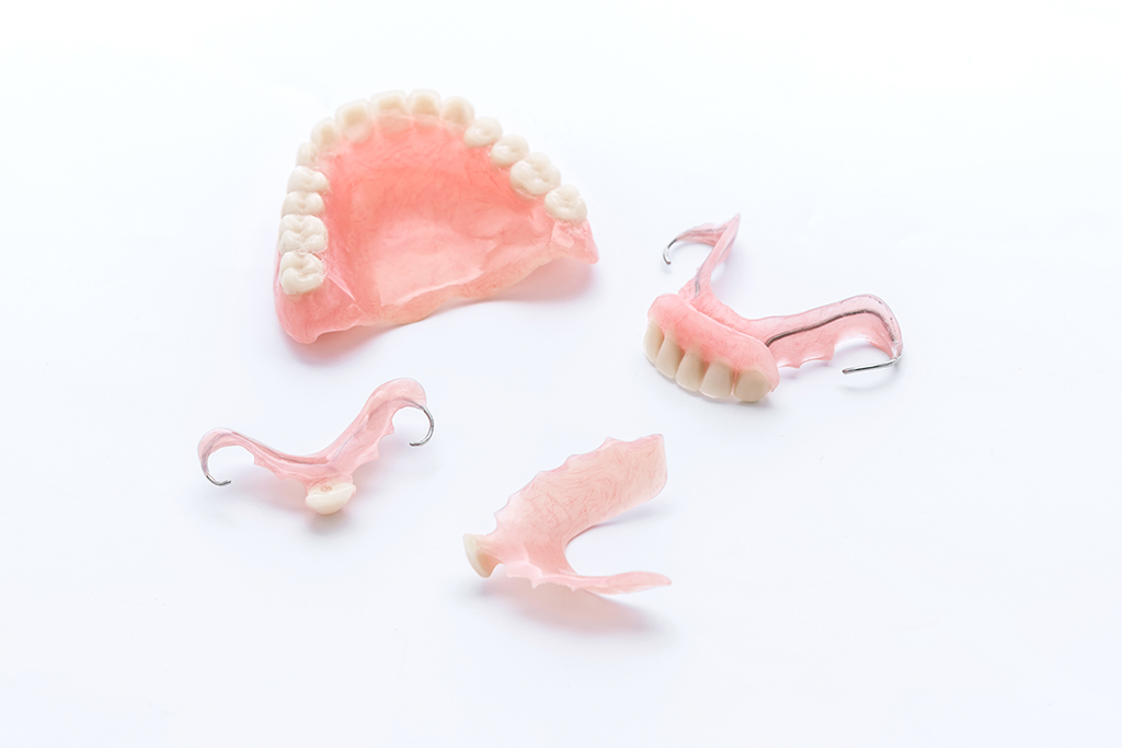 “入れ歯や義歯の種類
