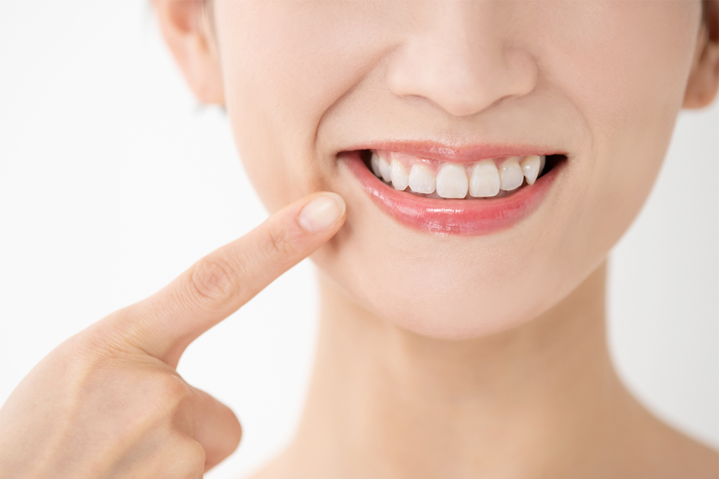歯の予防・クリーニングに通うメリット